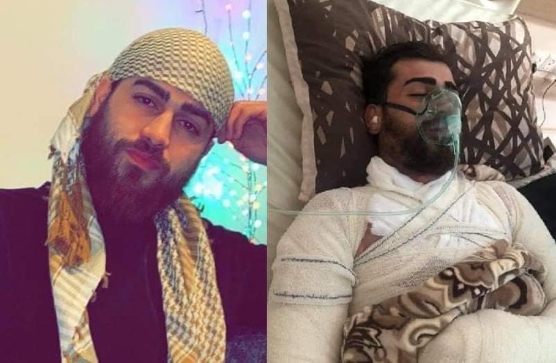 گەنجێک بەهۆی ئەوەی جگەرەی بەدەستەوەبووە لەکاتی بەنزین تێکردندا سووتا