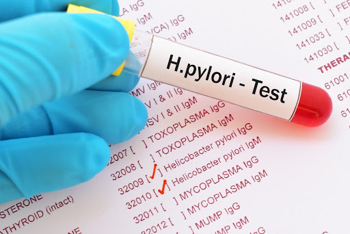 نەخۆشی H-pylori چییە؟